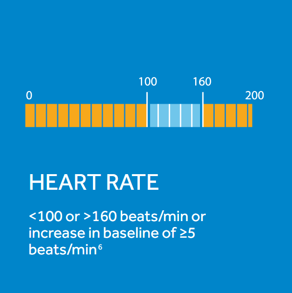 Heart Rate