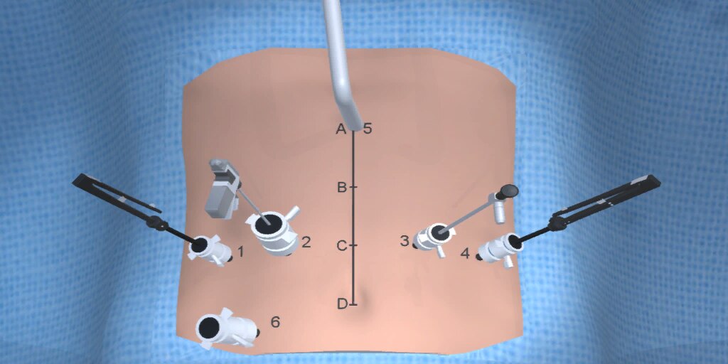 Figure 10b