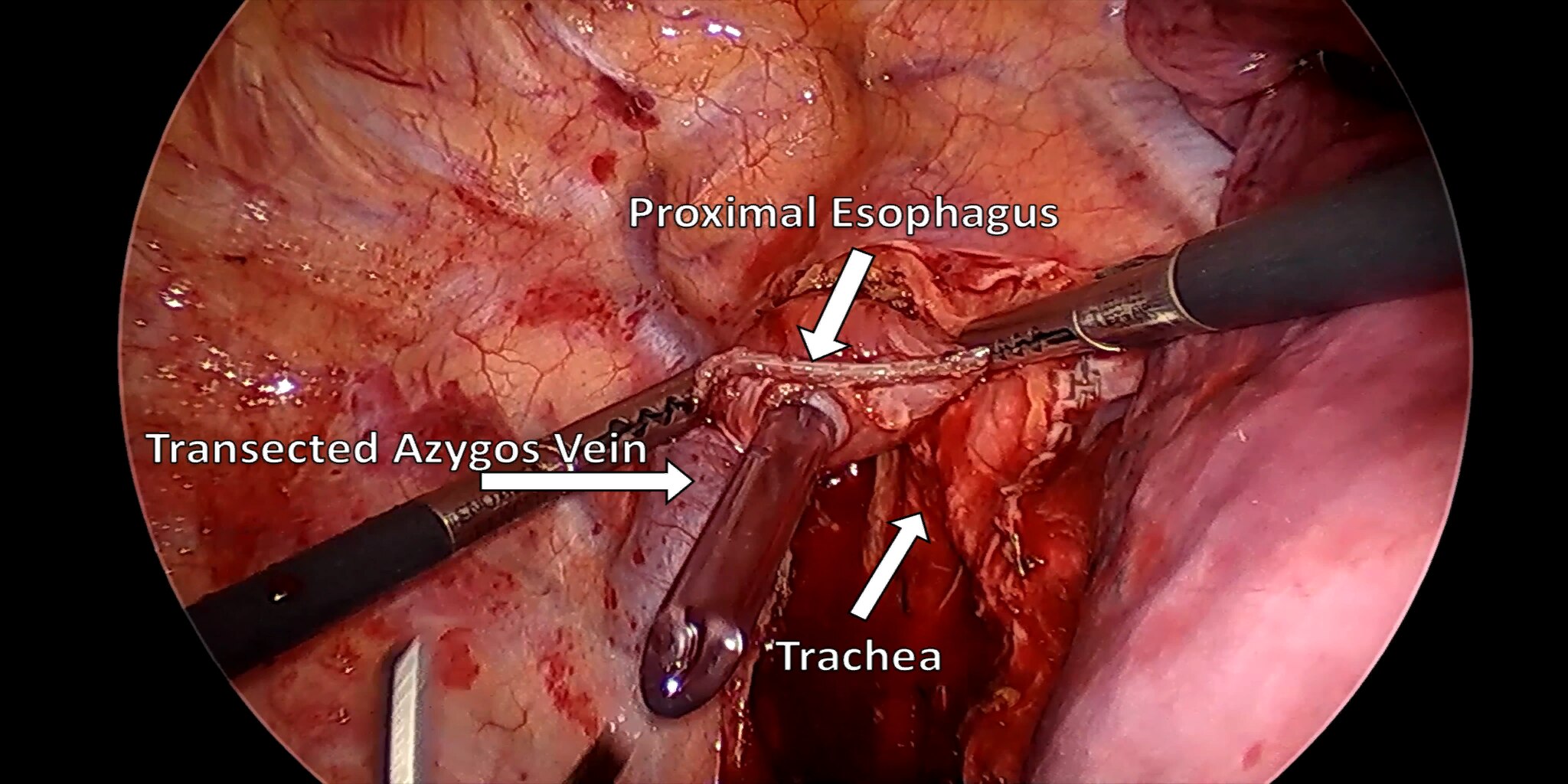 Figure 17a