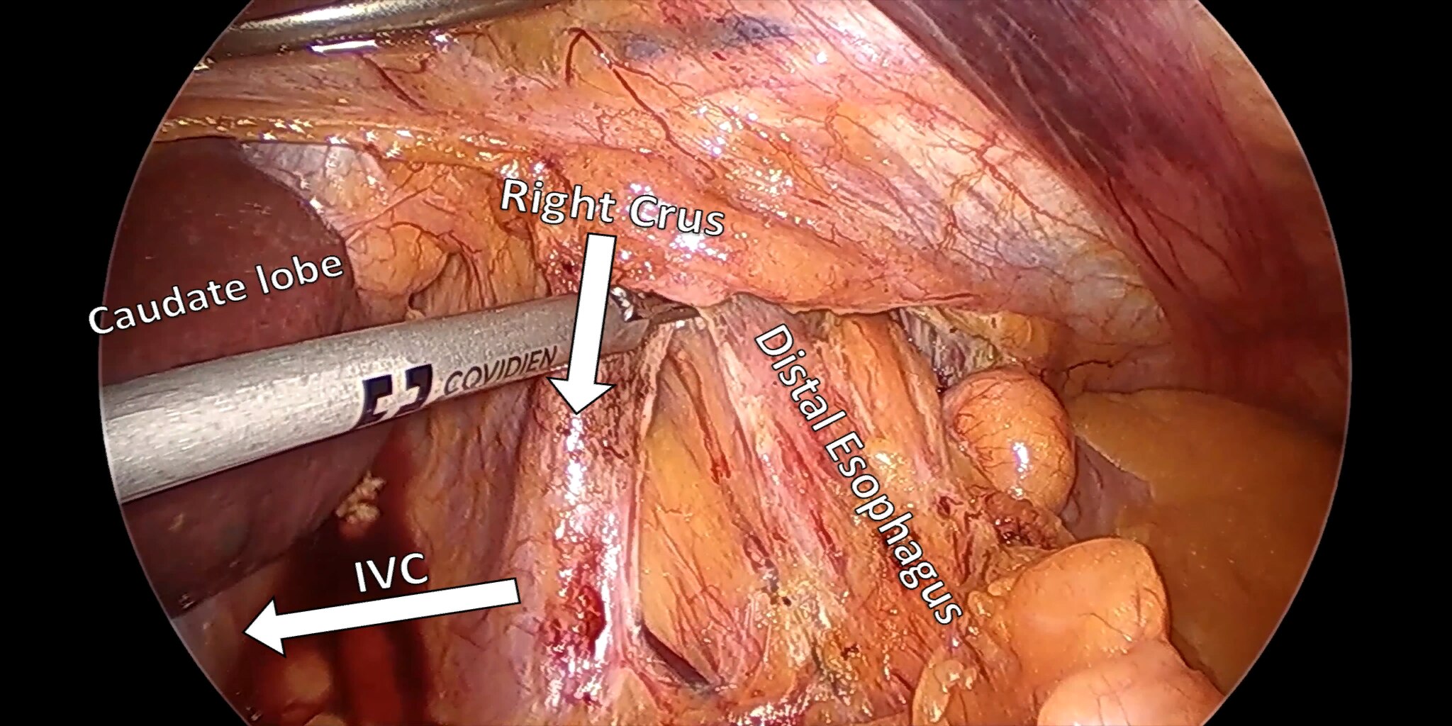 Figure 4a