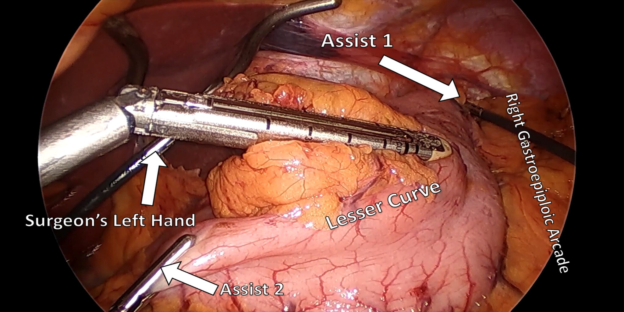 Figure 7a