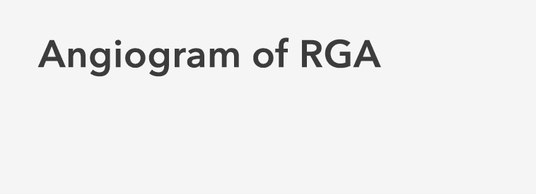 Angiogram of RGA