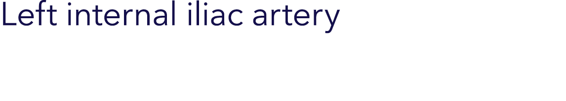 Left internal iliac artery