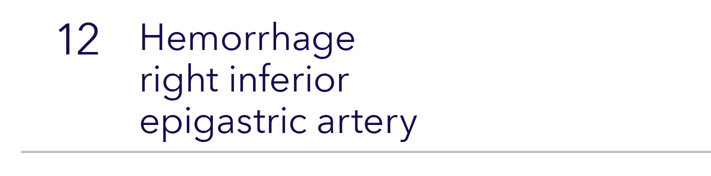 12,Hemorrhage  right inferior epigastric artery ,