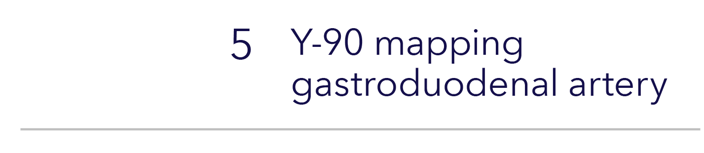 ,5,Y-90 mapping  gastroduodenal artery