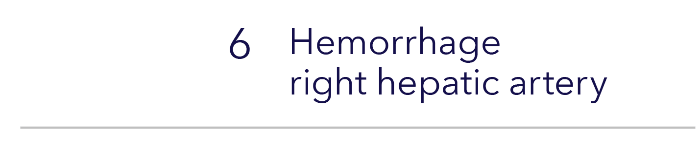 ,6,Hemorrhage right hepatic artery